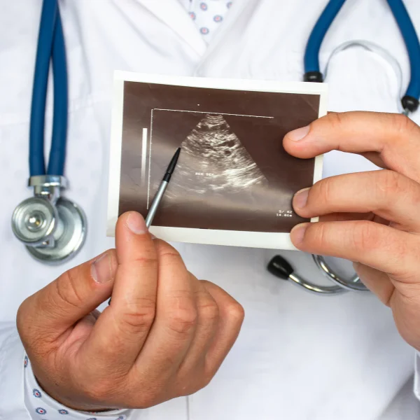 Kidney Disease in Pregnancy and Infants