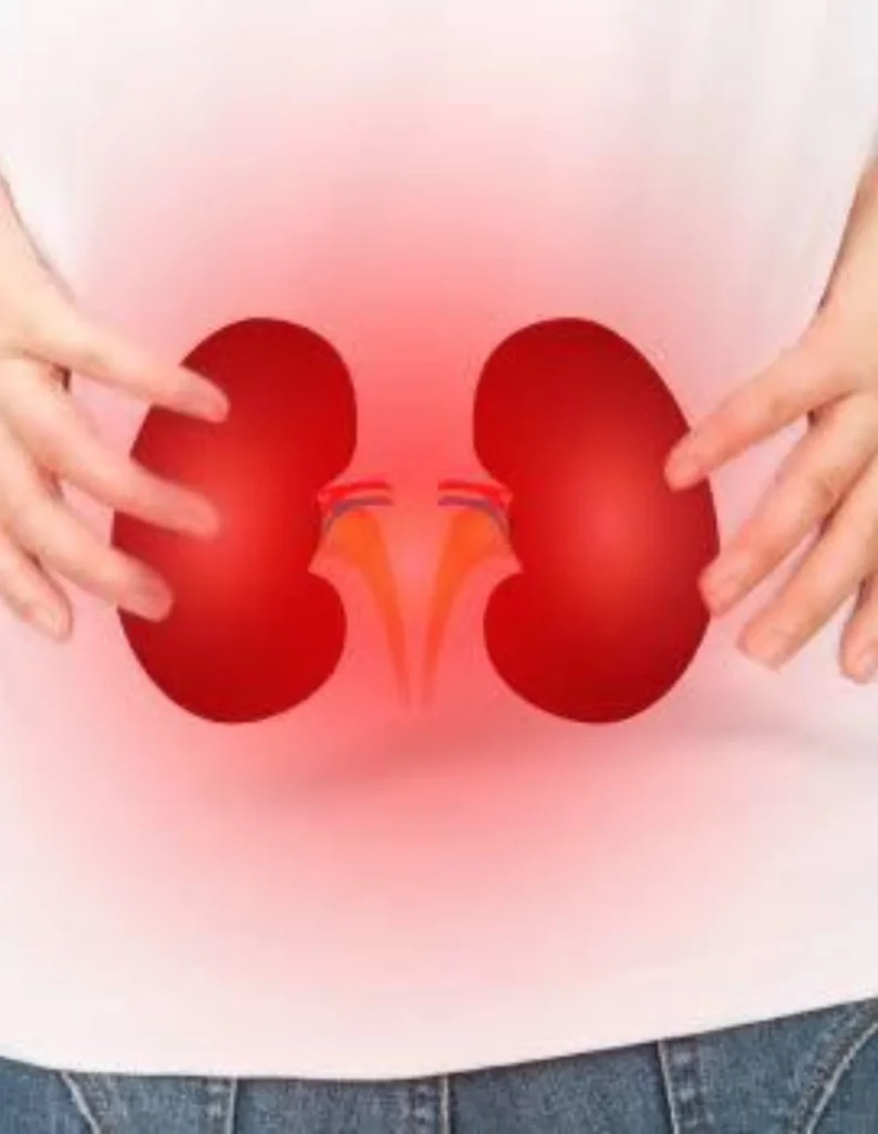 ACUTE KIDNEY INJUYRY
